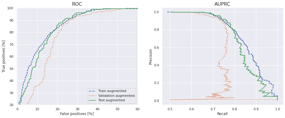 ROC and AUPRC curves for the augmented baseline model.