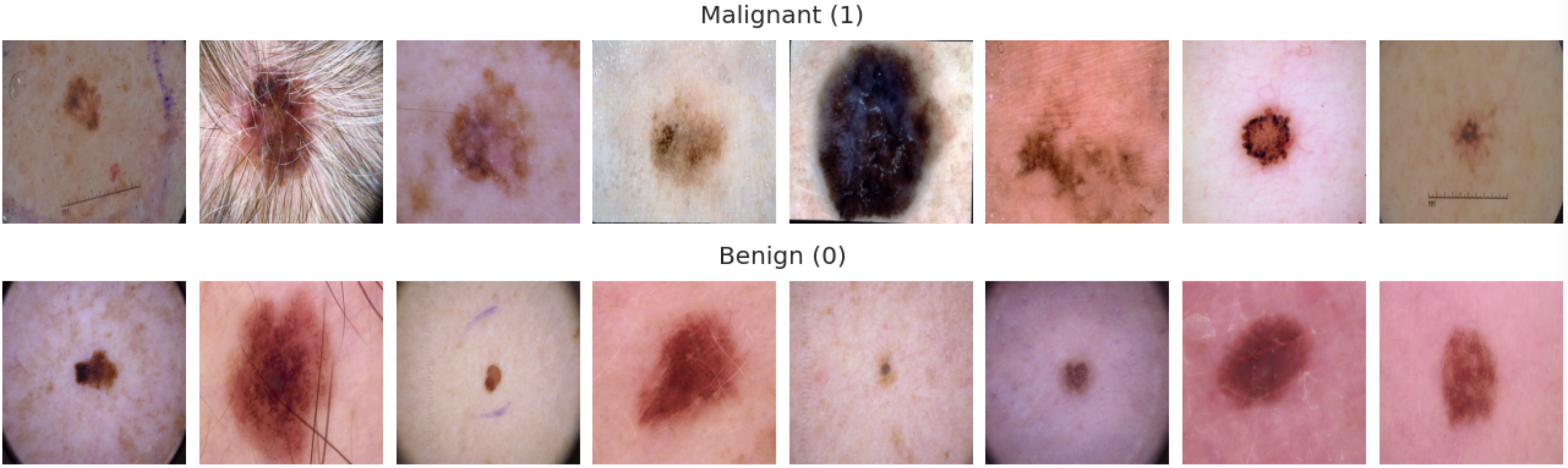 Malignant (upper) and benign (lower) sample images from the train data. Perhaps the malignant images are slightly uglier. I would't trust by own eyes on making the decision though.